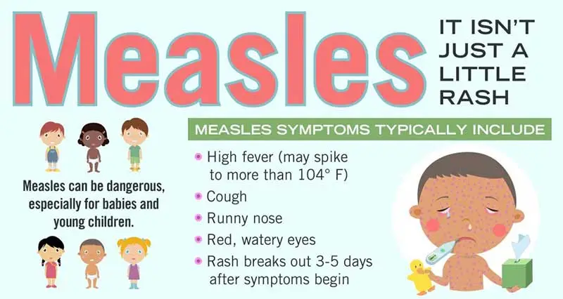 Measles, South coast public health coalition